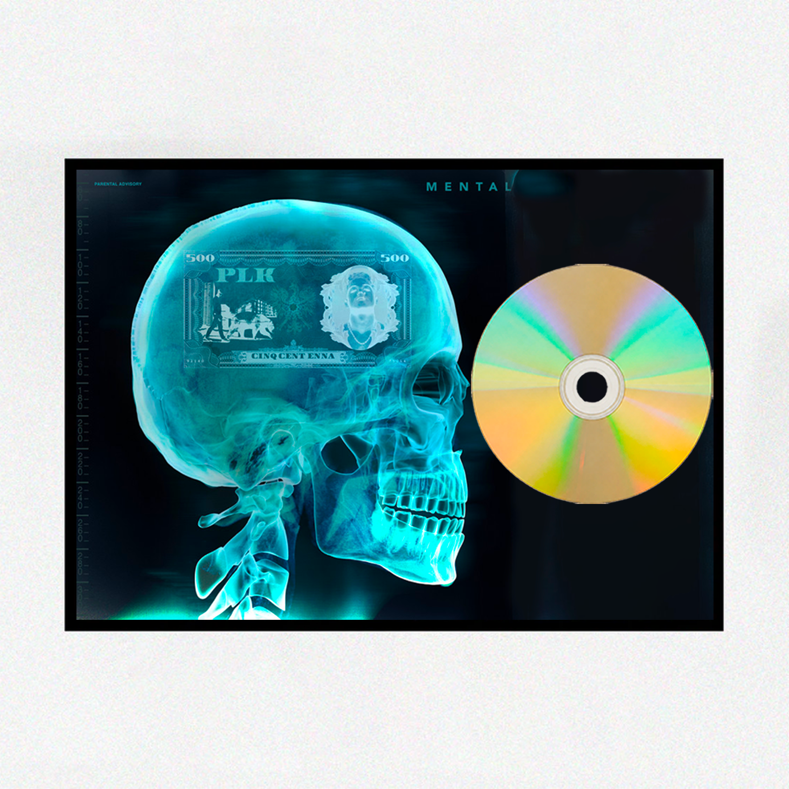 PLK - Mental